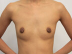 RGV Cosmetic Surgery Vein Care 