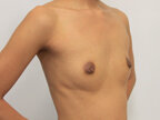 RGV Cosmetic Surgery Vein Care 