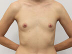 RGV Cosmetic Surgery Vein Care 