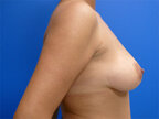 RGV Cosmetic Surgery Vein Care 