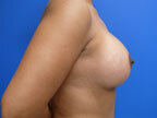 RGV Cosmetic Surgery Vein Care 