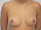RGV Cosmetic Surgery Vein Care 