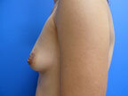 RGV Cosmetic Surgery Vein Care 