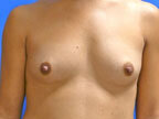RGV Cosmetic Surgery Vein Care 