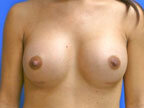 RGV Cosmetic Surgery Vein Care 