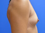 RGV Cosmetic Surgery Vein Care 