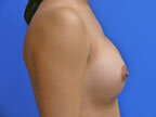 RGV Cosmetic Surgery Vein Care 