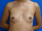 RGV Cosmetic Surgery Vein Care 
