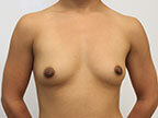 RGV Cosmetic Surgery Vein Care 