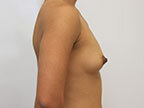 RGV Cosmetic Surgery Vein Care 