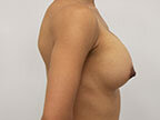 RGV Cosmetic Surgery Vein Care 