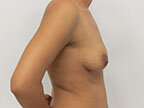 RGV Cosmetic Surgery Vein Care 