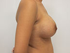 RGV Cosmetic Surgery Vein Care 
