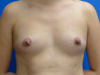 RGV Cosmetic Surgery Vein Care 