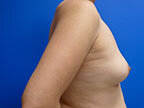 RGV Cosmetic Surgery Vein Care 