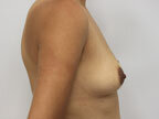 RGV Cosmetic Surgery Vein Care 