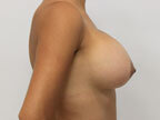 RGV Cosmetic Surgery Vein Care 