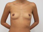 RGV Cosmetic Surgery Vein Care 