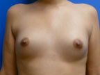 RGV Cosmetic Surgery Vein Care 