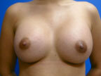 RGV Cosmetic Surgery Vein Care 