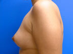 RGV Cosmetic Surgery Vein Care 