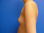 RGV Cosmetic Surgery Vein Care 