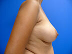 RGV Cosmetic Surgery Vein Care 