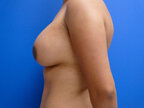 RGV Cosmetic Surgery Vein Care 