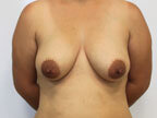 RGV Cosmetic Surgery Vein Care 