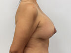 RGV Cosmetic Surgery Vein Care 