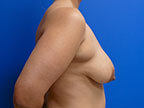 RGV Cosmetic Surgery Vein Care 