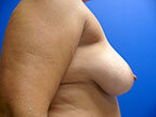 RGV Cosmetic Surgery Vein Care 