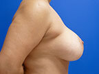 RGV Cosmetic Surgery Vein Care 