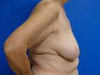 RGV Cosmetic Surgery Vein Care 