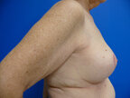 RGV Cosmetic Surgery Vein Care 