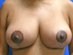 RGV Cosmetic Surgery Vein Care 