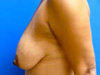 RGV Cosmetic Surgery Vein Care 