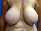 RGV Cosmetic Surgery Vein Care 