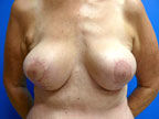 RGV Cosmetic Surgery Vein Care 
