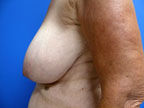 RGV Cosmetic Surgery Vein Care 