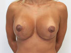 RGV Cosmetic Surgery Vein Care 