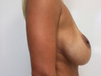 RGV Cosmetic Surgery Vein Care 