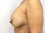 RGV Cosmetic Surgery Vein Care 