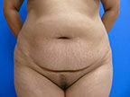 RGV Cosmetic Surgery Vein Care 