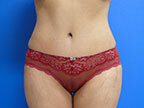 RGV Cosmetic Surgery Vein Care 