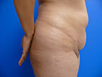 RGV Cosmetic Surgery Vein Care 