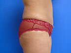 RGV Cosmetic Surgery Vein Care 