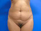 RGV Cosmetic Surgery Vein Care 
