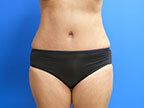 RGV Cosmetic Surgery Vein Care 