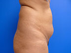 RGV Cosmetic Surgery Vein Care 